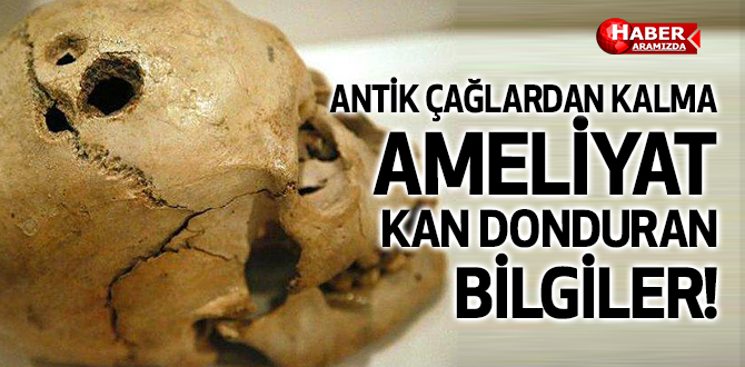 Antik Çağlardan Kalma Kan Donduran Bir Ameliyat Prosedürü: Trepanasyon