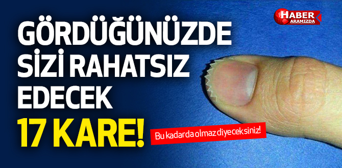 Görenleri Rahatsız Eden 17 Kare! İçerikteki görseller rahatsız edicidir!