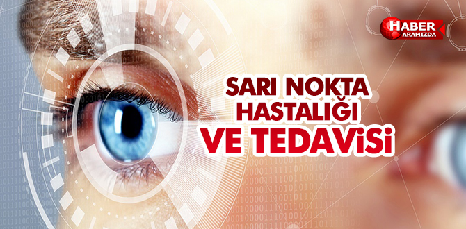 SARI NOKTA HASTALIĞI