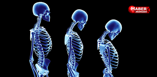 Osteoporoz’u olan kişiler dikkat!