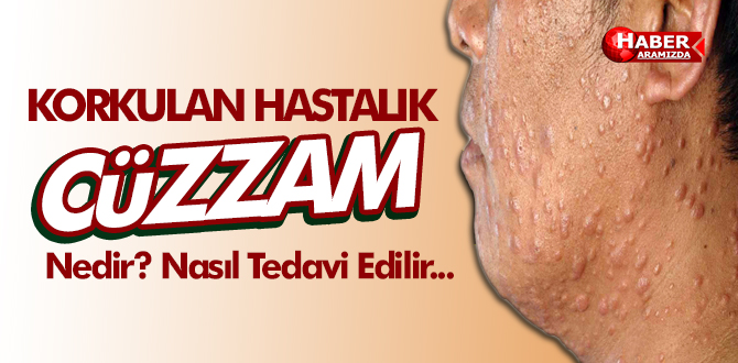 CÜZZAM NEDİR?