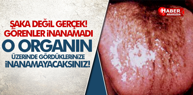 Bu Organın Üzerinde Kılların Olabileceğine İnanamayacaksınız!