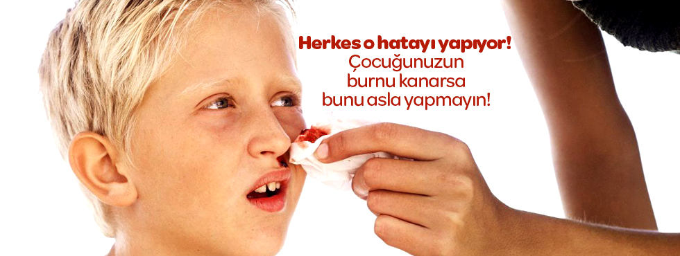 Burnunuz kanarsa bunu asla yapmayın!