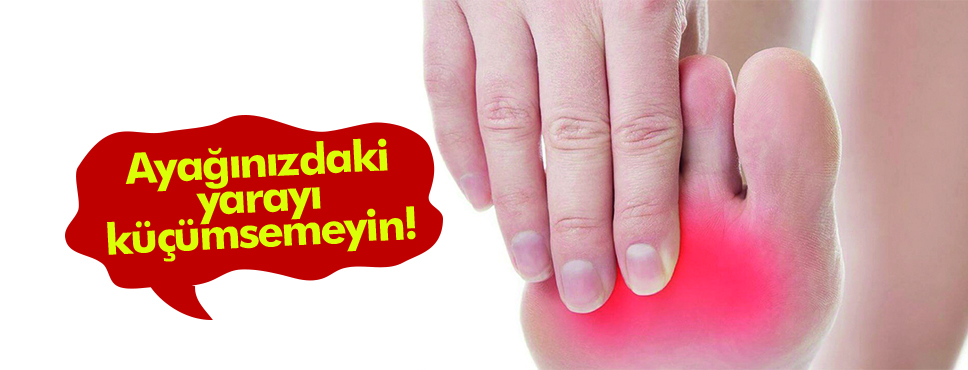 Ayağınızdaki yarayı küçümsemeyin!
