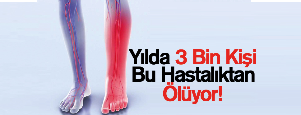 Yılda 3 Bin Kişi Bu Hastalıktan Ölüyor!