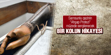 Samsun’da Bir kolun hikayesi
